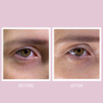 Youth Lab. Peptides Spring Hydra-Gel Eye Patches Μάσκα Mατιών με Πεπτίδια Μονοδόση - Image 2