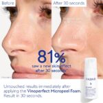 Caudalie Vinoperfect Brightening Micropeel Foam Αφρός Καθαρισμού Προσώπου, 100ml - Image 4