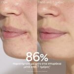 Caudalie Vinopure Blemish Control Salicylic Serum Ορός Προσώπου κατά των Ατελειών, 30ml - Image 4