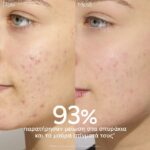 Caudalie Vinopure Moisturizing Mattifying Fluid Ενυδατική Κρέμα για Επιδερμίδες με Τάση Ακμής, 60ml - Image 2