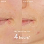 Caudalie Vinopure Salicylic Spot Solution Kρέμα Τοπικής Εφαρμογής για Σπυράκια, 15ml - Image 3
