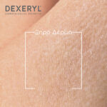 Dexeryl Cleansing Oil Λάδι Καθαρισμού για Πρόσωπο & Σώμα, 500ml - Image 2