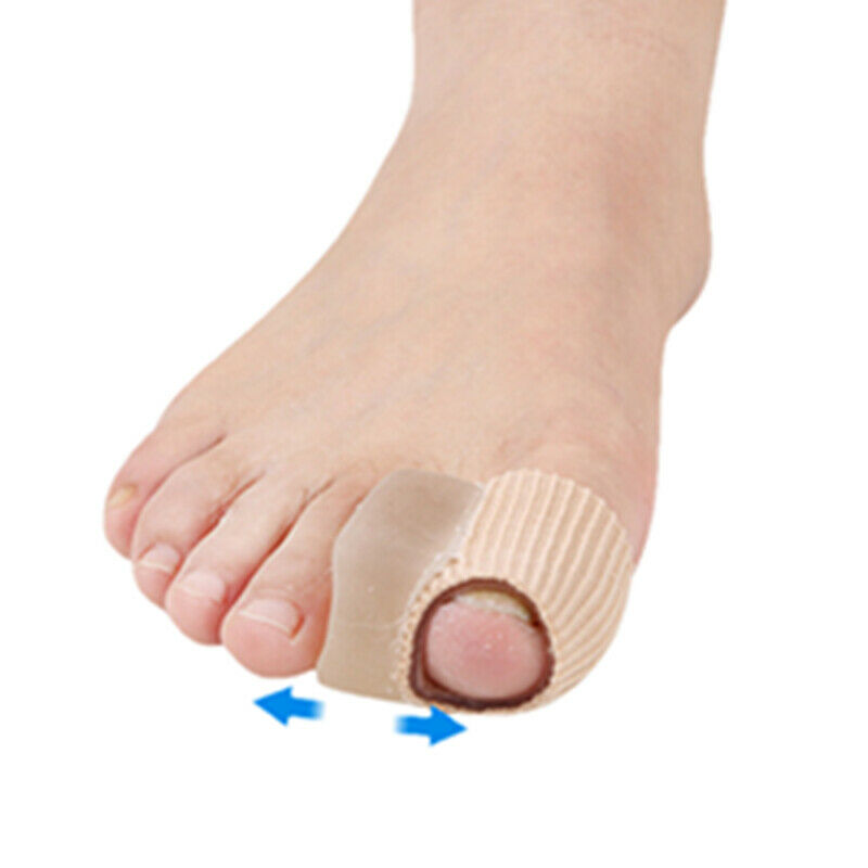medical-brace-Υφασμάτινο-προστατευτικό-κάλυμμα-δακτύλων-με-διαχωριστικό-σιλικόνης-mbfc1121.jpg Medical Brace Υφασμάτινο προστατευτικό κάλυμμα δακτύλων με διαχωριστικό σιλικόνης (MB.FC.112) - Image 1