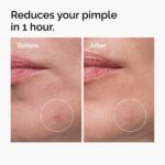 The Ordinary Sulfur 10% Powder to Cream Concentrate Κρέμα Προσώπου κατά των Ατελειών & της Ακμής, 5g - Image 3